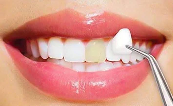 best cosmetic dentistry dental clinic in vellore