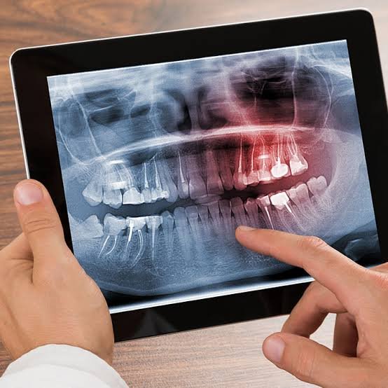 digital x ray dental centre in vellore