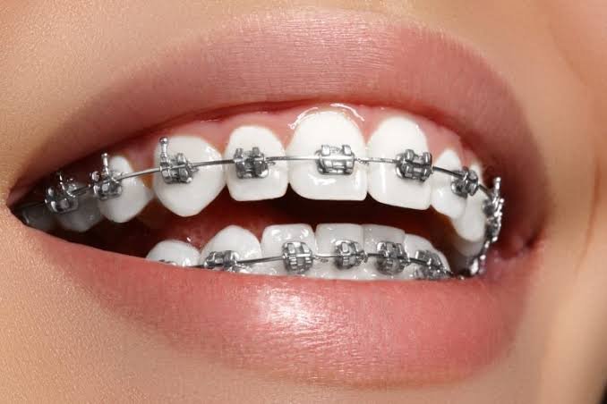 orthodontic dental centre in vellore